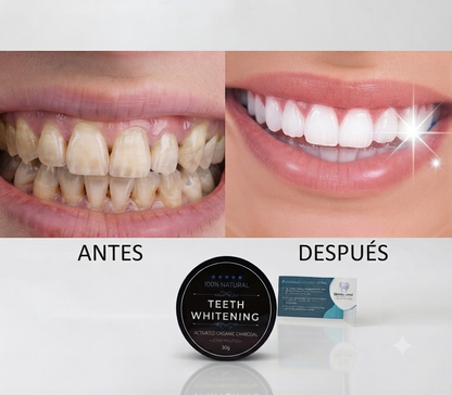 Teeth Whitening® – El Secreto Natural para Despertar la Magia de tu Sonrisa y Volver a Brillar sin Miedo