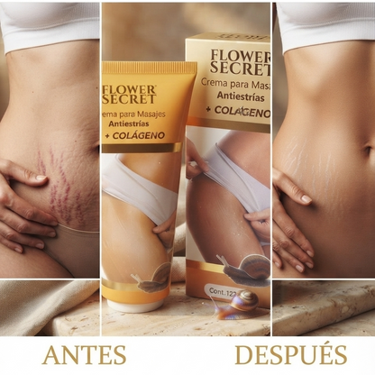 Crema Corporal para Masajes Anti Estrías
